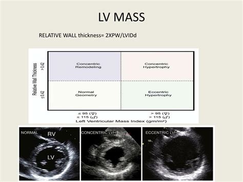 lv wall thickness echo.